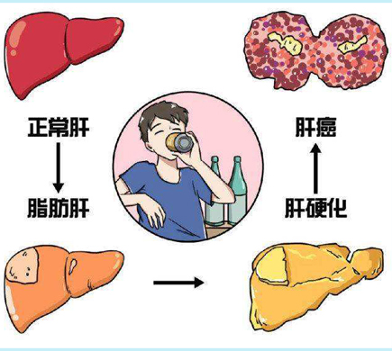 图腾医生专家指出：脂肪肝不仅伤肝，还有这些危害！教你4种养肝护肝的好方法！