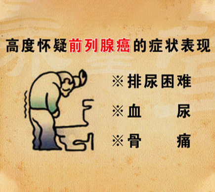 前列腺癌如何做早期筛查？前列腺癌症状有哪些？图腾益生专家说：早期治愈率或达90%！