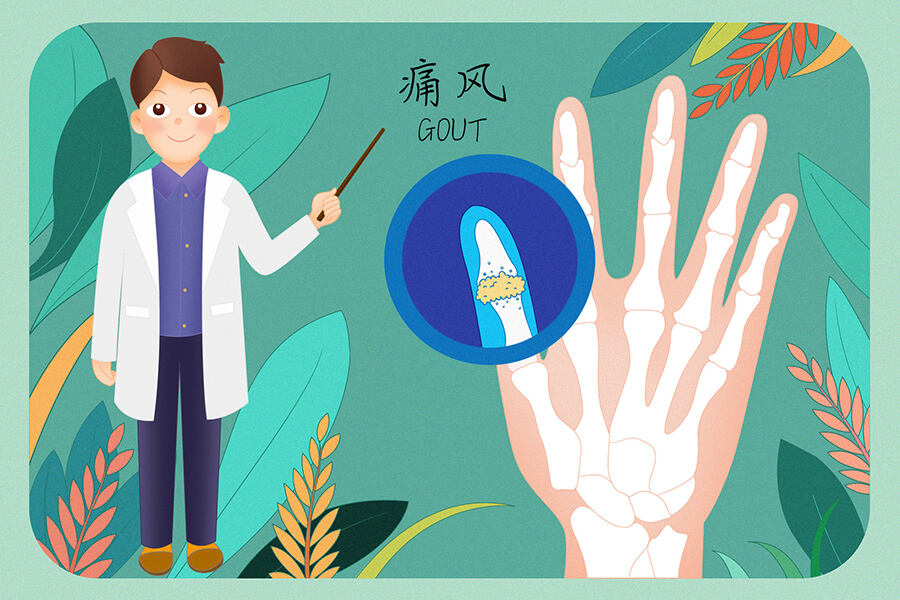 图腾益生风之友浅谈痛风的征兆友哪些？