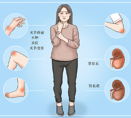 痛风持续一个多月了一直没好，图腾益生风之友专家告诉你原因