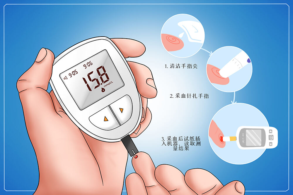 图腾益生怡唐舒诠释高血糖是什么原因引起的
