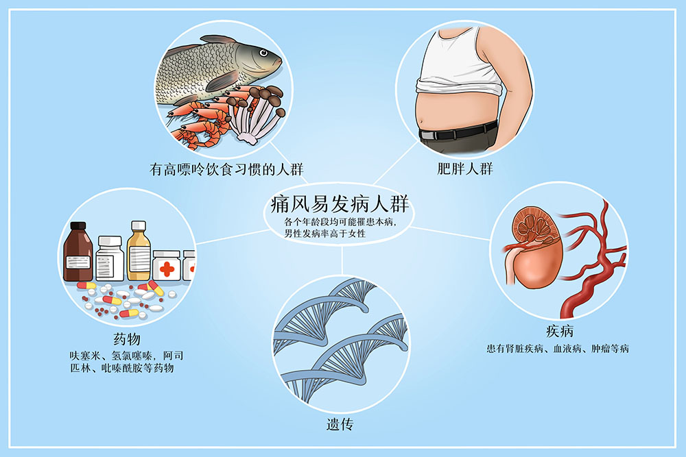 高尿酸的症状有哪些？风之友给您解答