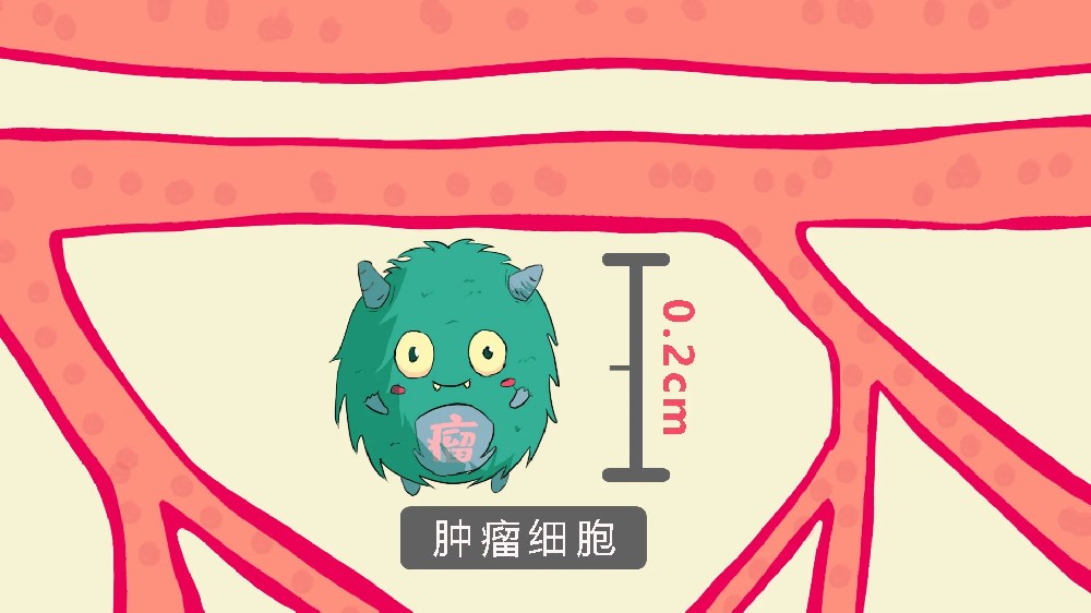 淋巴癌治愈率高吗？具体与什么因素相关？治疗方式新进展！